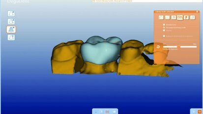 CAD/CAM Technology: a review