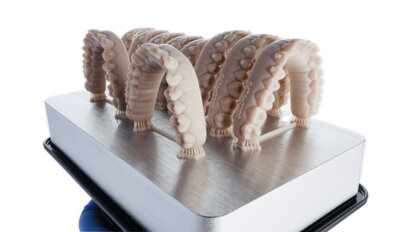 Aesthetic treatment with in-house aligners