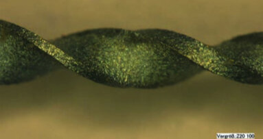 Παρακολούθηση ενδοδοντικών περιστατικών με έντονες κάμψεις στους ριζικούς σωλήνες, του Dr Thomas Rieger