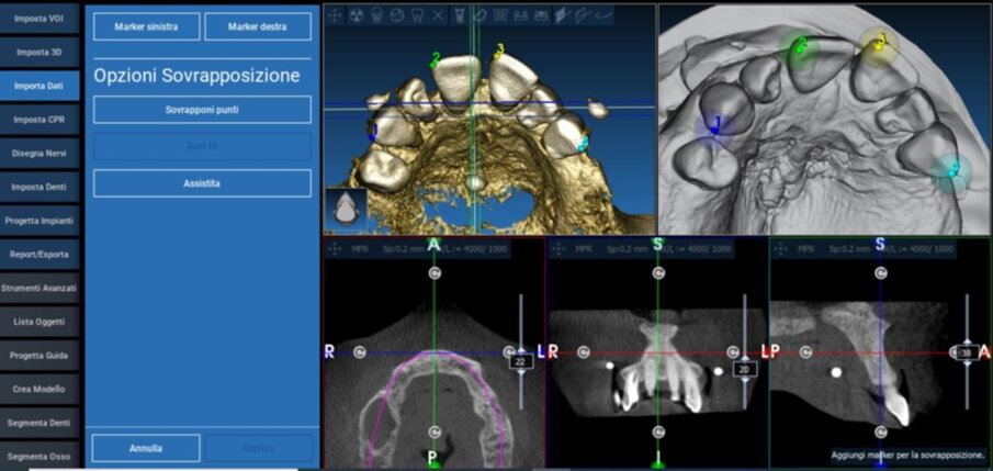 Figg. 15, 16_ Pianificazione con software Realguide.