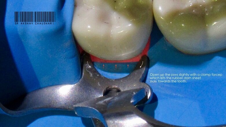 Fig - 2 Reposition the clamp