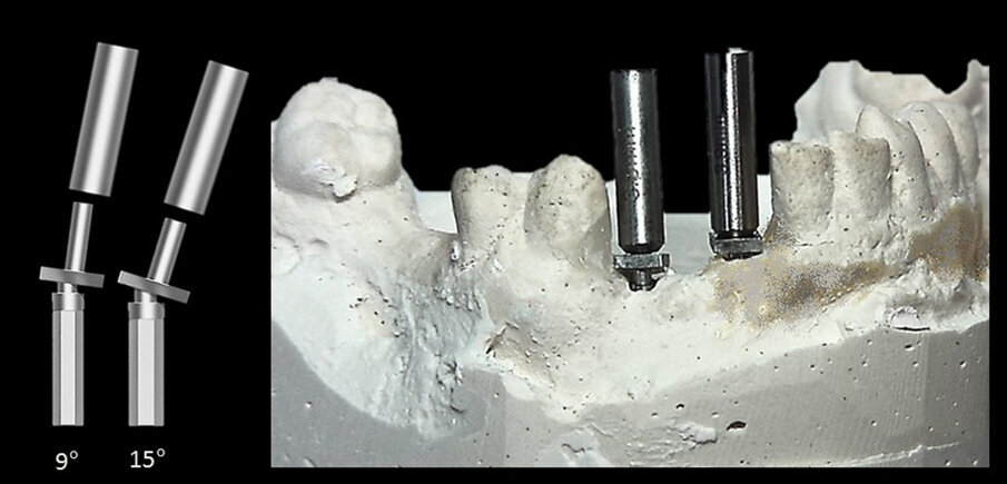 Figs. 8a & b: Corrected 1.0 mm offset guide posts with 3.9 mm upper parts for alignment of 4.0 mm guide sleeves placed into the post holes on the cast.