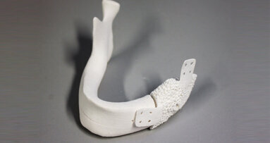 Neuartiger Knochenersatz soll Knochen zum Wachsen anregen