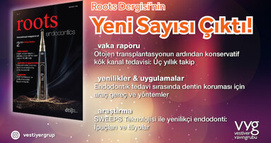 Çaylar Hazırsa Roots Dergisi’ne Yakından Bakalım