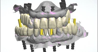 The fully digital Pro Arch protocol