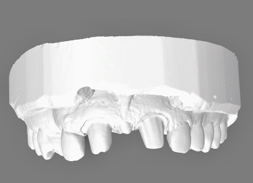 Fig. 6: Virtual patient crown case.
