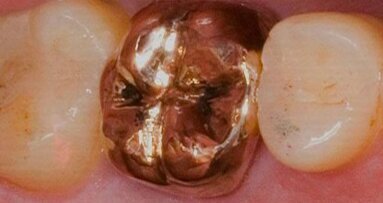 Vraag naar dentaal goud daalt sterk