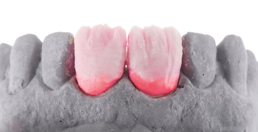 Fig. 7 & 8: Alternating the layers with the materials chosen during shade determination