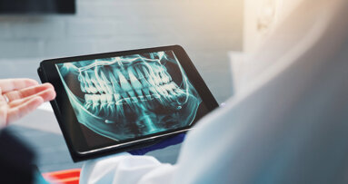 Pearl AI reveals hidden oral health crisis