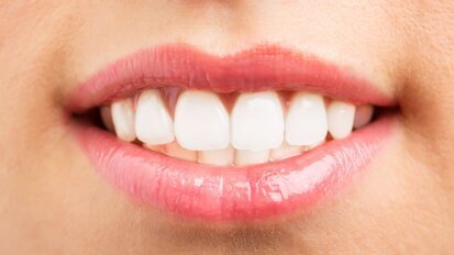 FDI lanceert Proud Mouth Challenge