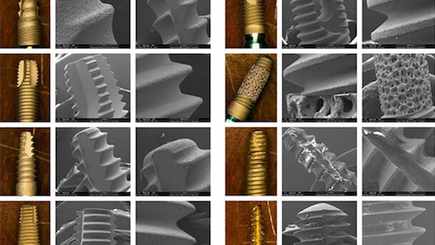 Una nueva forma de diseñar implantes dentales