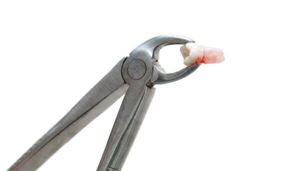 Acht jaar cel geëist tegen ‘horrortandarts’