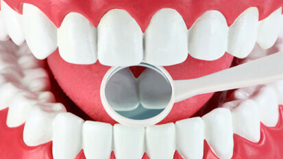 Head and neck cancer may drive on periodontitis