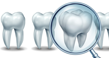 S3-Leitlinie „Fissuren- und Grübchenversiegelung“ S3-Leitlinie „Fissuren- und Grübchenversiegelung“