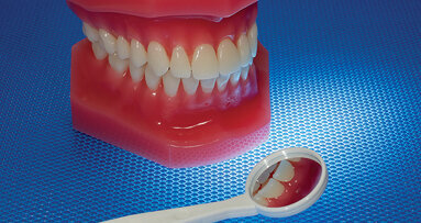 Genetic variation linked to increased periodontitis risk