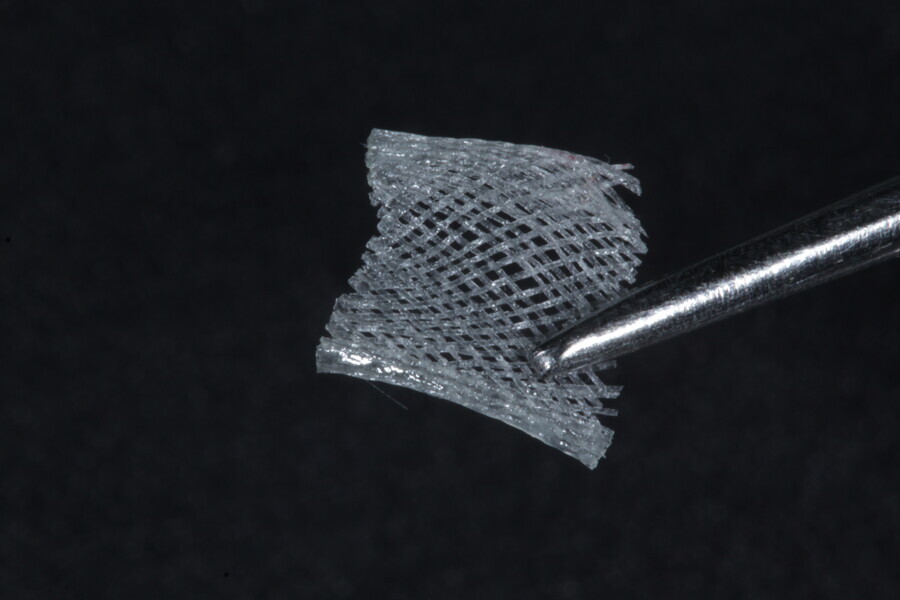 Fig. 40: Fibre-reinforced membrane cube containing fibre membrane within the composite resin material (Fibrafill CUBE).