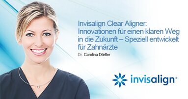 Nächste Gelegenheit mehr über Aligner zu erfahren