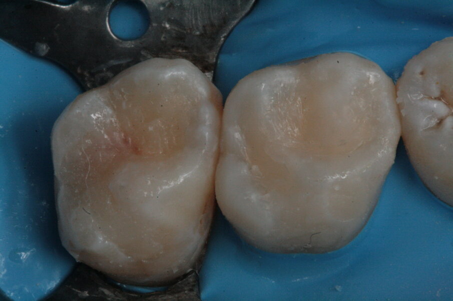 Fig. 8_Restauri ultimati.