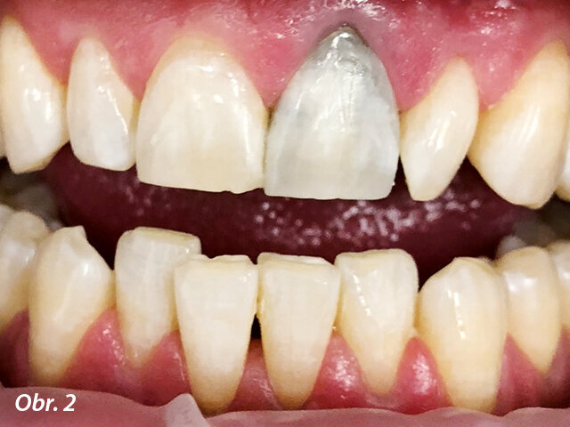 Obr. 2: Během ošetření