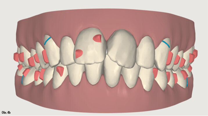 Kazuistika - popis v textu
