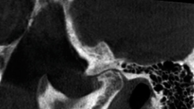 CBCT: ultimi abstracts riportati dalla letteratura