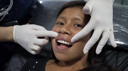 The result after the fixation of a dental bridge made using CEREC. (Photograph: Dentsply Sirona)