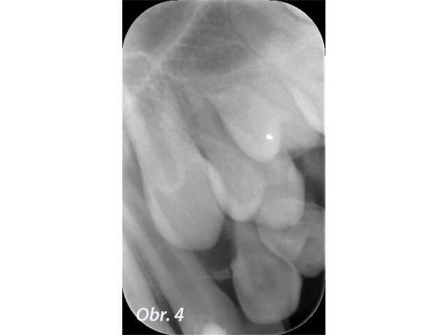 Obr. 4: Před ošetřením (2012)