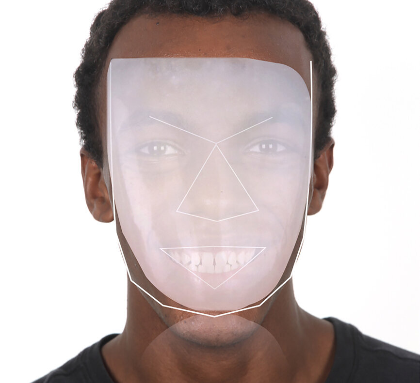 Fig. 17: Facial analysis for planning the individual tooth shape.