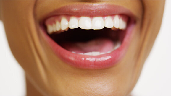 Oberstes Ziel: Verbesserung der Mundgesundheit