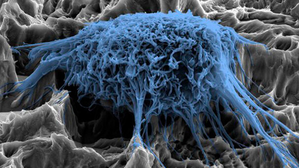 Dalla ricerca un nuovo rivestimento per prevenire le infezioni agli impianti dentali