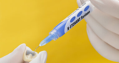 Shining a light on Kuraray Noritake's lesser-known stars