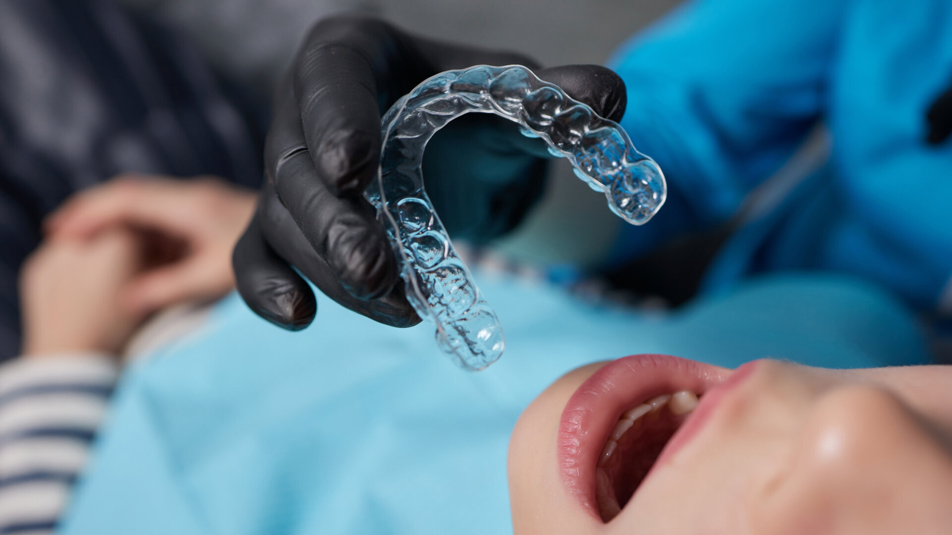 Drop in orthodontic case starts spooks Align Technology investors