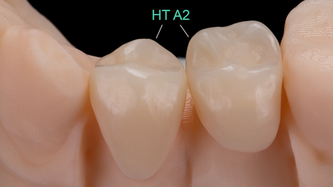 Fig. 8: The accuracy of fit and the warm colour effect in this pure state were convincing.
