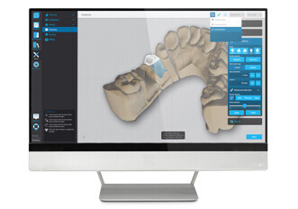 Dental Wings – DWOS Chairside Design Software