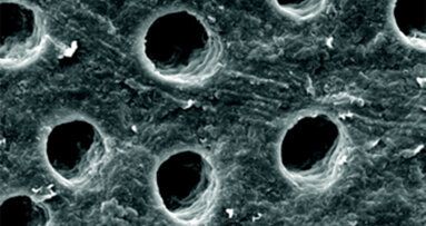 Zkušenosti s hypersenzitivitou dentinu při používání zubní pasty  s přidaným biosklem