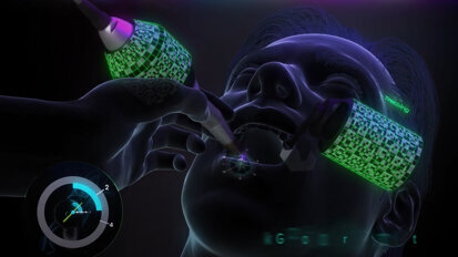 X-Guide, the navigation system that’s like a GPS for your drill X-Guide, the navigation system that’s like a GPS for your drill