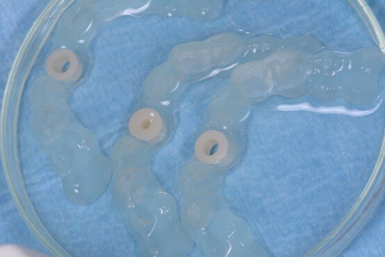 Fig. 13_Le dime sono stampate in materiale rigido e trasparente (DS3000, DWS Systems) con stampante 3D stereolitografica- laser (XFAB 3500PD, DWS Systems). Le dime sono identiche, e differiscono tra loro solo per il diametro della boccola fresata in zirconia incassata all’interno di esse.