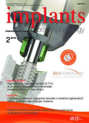 implants Italy No. 2, 2018 implants Italy No. 2, 2018
