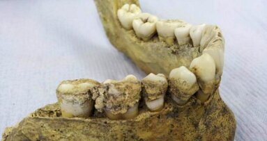 Pesquisadores encontram a primeira evidência de consumo de leite em antiga placa dental