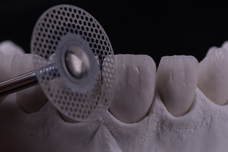 Fig. 69: Disk bur being used to groove details.