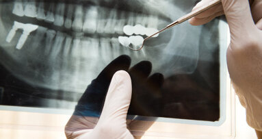 No loss of diagnostic imaging quality with low-radiation settings