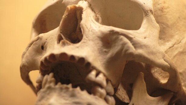 Drukowane implanty z PW pomagają w odbudowie kości