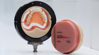 Ivoclar and exocad extend options for digital dentures with integration in DentalCAD