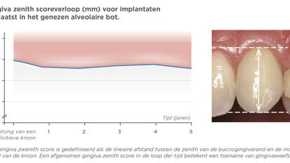 Resultaten die gemoedsrust geven