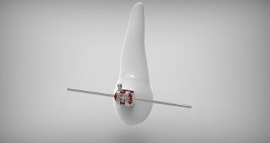 W Polsce rośnie popularność leczenia ortodontycznego