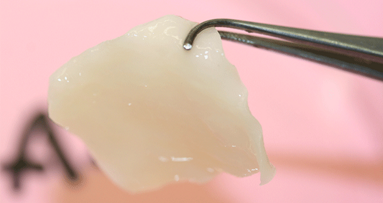 Neue Möglichkeiten für die Gesichtschirurgie