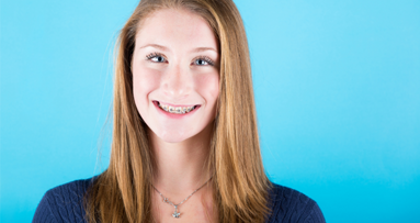 Zahnspangenträger glücklich mit Ergebnis