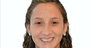 Diseño digital de la sonrisa con composites