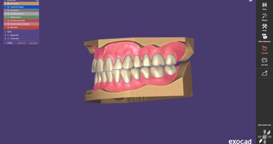 Exocad launches Inspira Denture Tooth Library