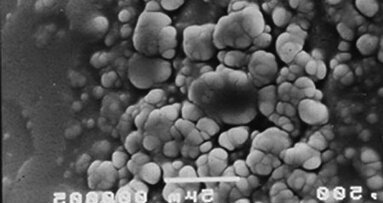 ADF 2014 : conférences «Une bouche en toute sécurité »